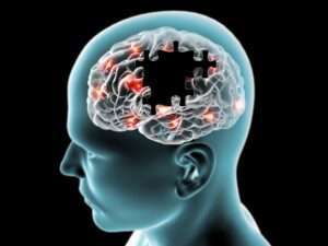 Alzheimer causes symptômes et traitement